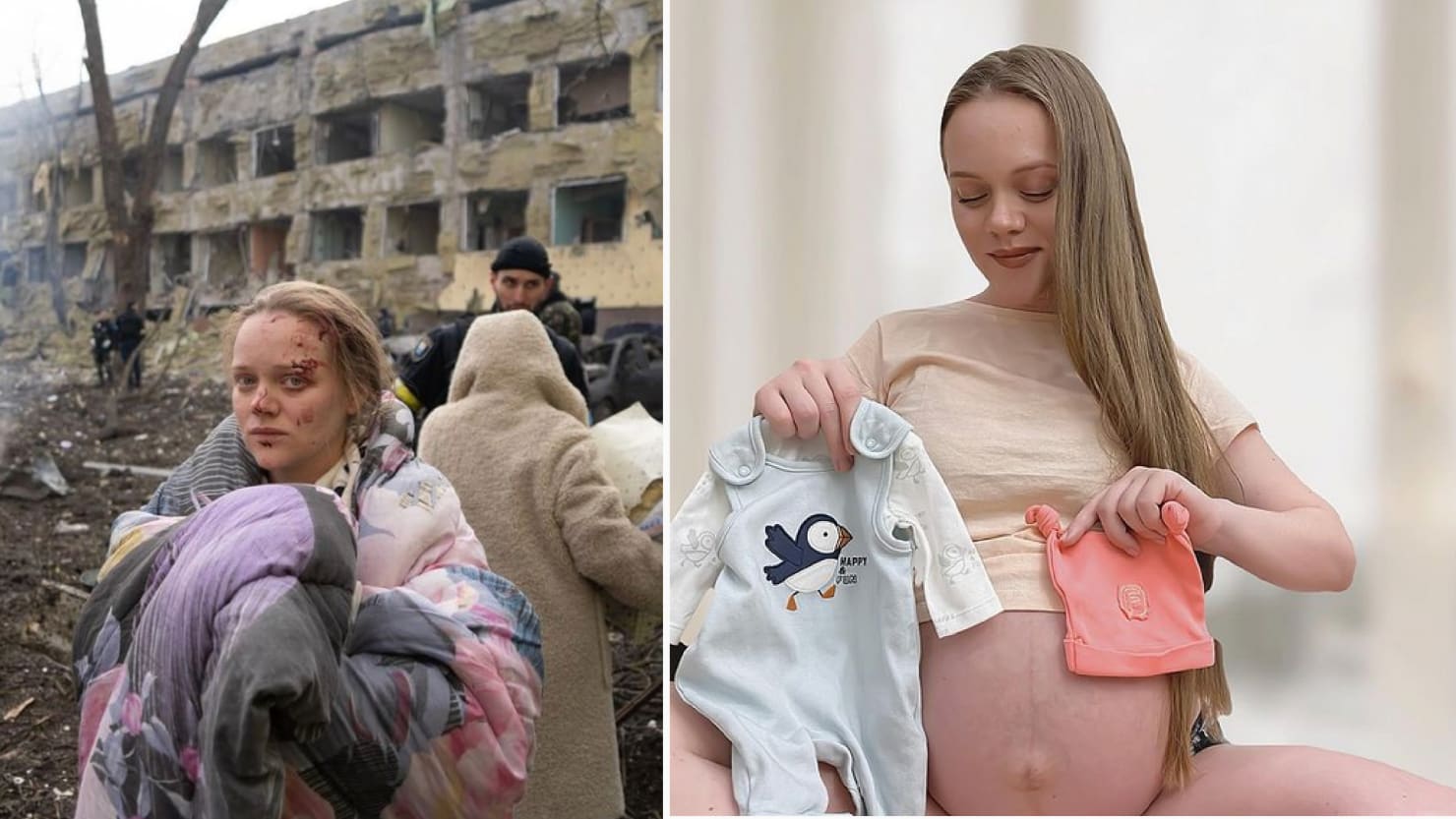 Rusia dice que la mujer embarazada herida es un actor de crisis. En realidad es una bloguera embarazada.