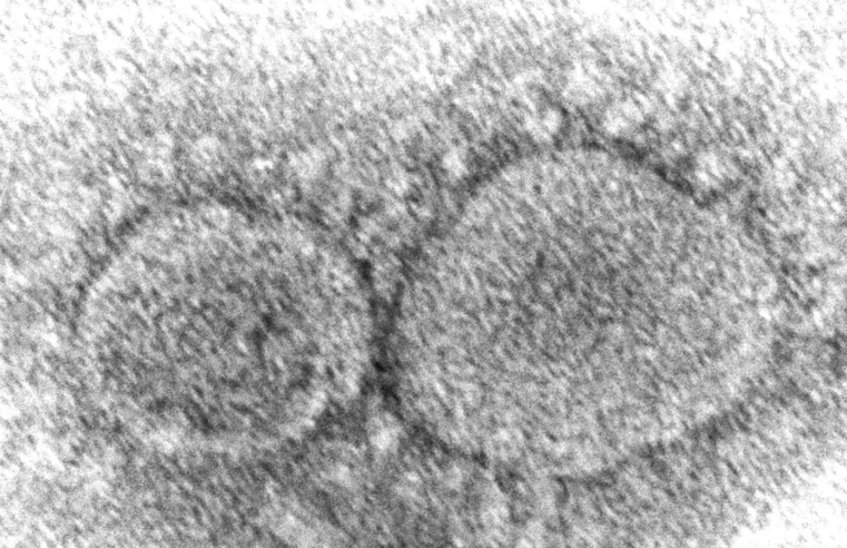 Los orígenes del coronavirus siguen siendo un misterio 3 años después de la pandemia