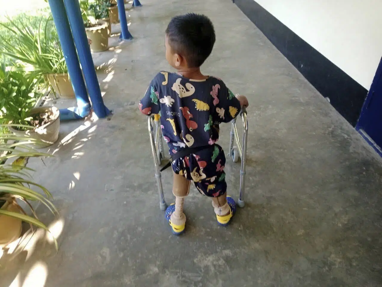 ‘Solo quiero que me devuelvan las piernas’: se disparan las víctimas de las minas terrestres en Myanmar