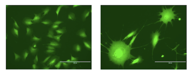Imágenes microscópicas de células epiteliales ováricas antes y después de la exposición crónica al arsénico